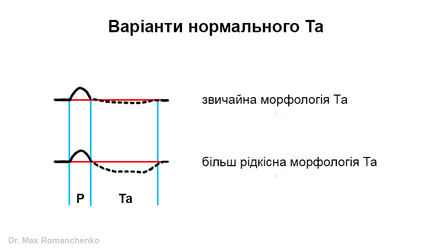 emery phenomenon Ta types